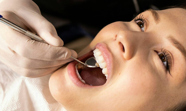 Стоматолог назвала способы избежать лишних пломб